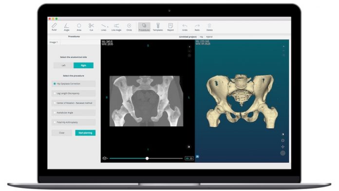 Startup de Braga entra no mercado medico dos EUA