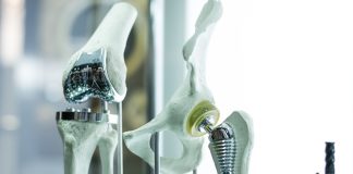 Na foto: implantes personalizados desenvolvidos pelo projeto ADAPT