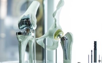 Na foto: implantes personalizados desenvolvidos pelo projeto ADAPT