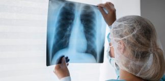 ANAUDI alerta para risco de colapso no setor convencionado